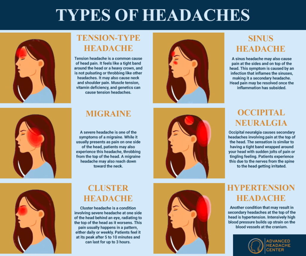 types migraine
